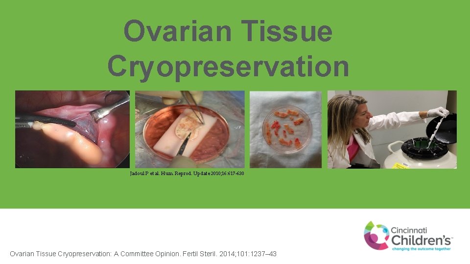 Ovarian Tissue Cryopreservation Jadoul P et al. Hum. Reprod. Update 2010; 16: 617 -630