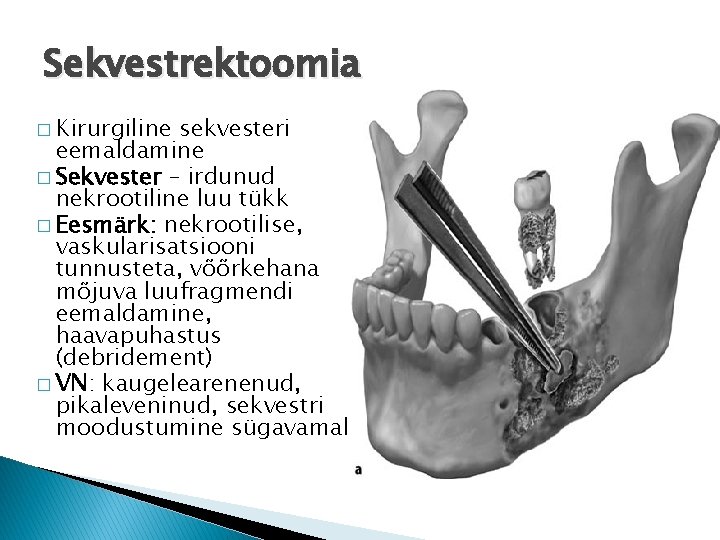 Sekvestrektoomia � Kirurgiline sekvesteri eemaldamine � Sekvester – irdunud nekrootiline luu tükk � Eesmärk: