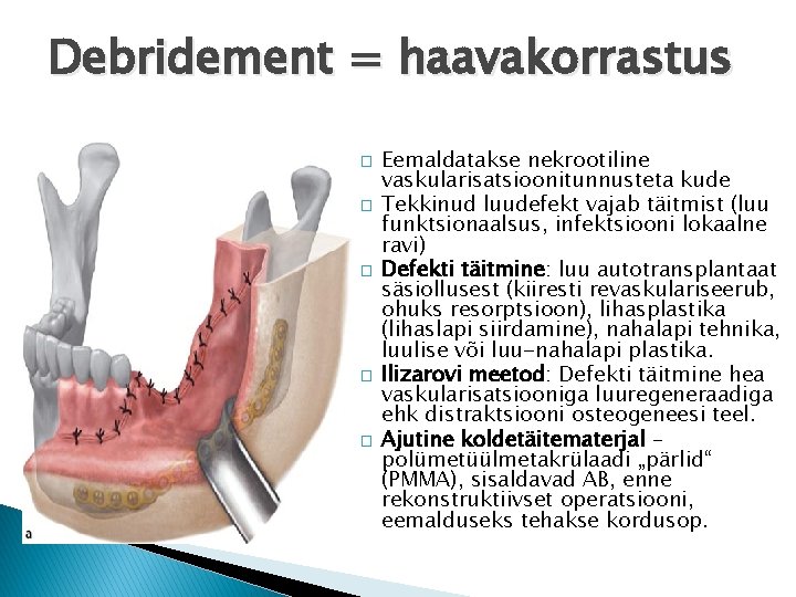 Debridement = haavakorrastus � � � Eemaldatakse nekrootiline vaskularisatsioonitunnusteta kude Tekkinud luudefekt vajab täitmist