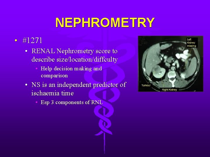 NEPHROMETRY • #1271 • RENAL Nephrometry score to describe size/location/diffculty • Help decision making