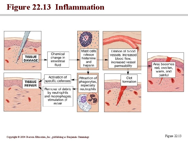 Figure 22. 13 Inflammation Copyright © 2004 Pearson Education, Inc. , publishing as Benjamin Figure 22. 13 Inflammation Copyright © 2004 Pearson Education, Inc. , publishing as Benjamin