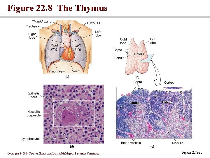 Figure 22. 8 The Thymus Copyright © 2004 Pearson Education, Inc. , publishing as Figure 22. 8 The Thymus Copyright © 2004 Pearson Education, Inc. , publishing as