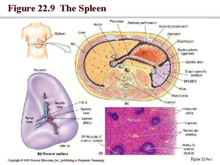 Figure 22. 9 The Spleen Copyright © 2004 Pearson Education, Inc. , publishing as Figure 22. 9 The Spleen Copyright © 2004 Pearson Education, Inc. , publishing as