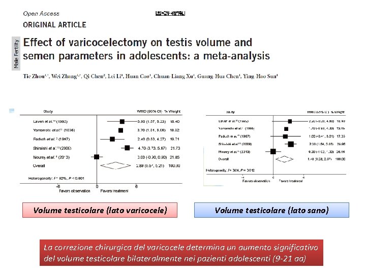 Volume testicolare (lato varicocele) Volume testicolare (lato sano) La correzione chirurgica del varicocele determina