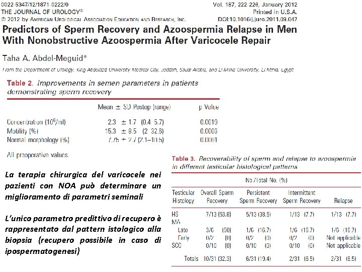 La terapia chirurgica del varicocele nei pazienti con NOA può determinare un miglioramento di