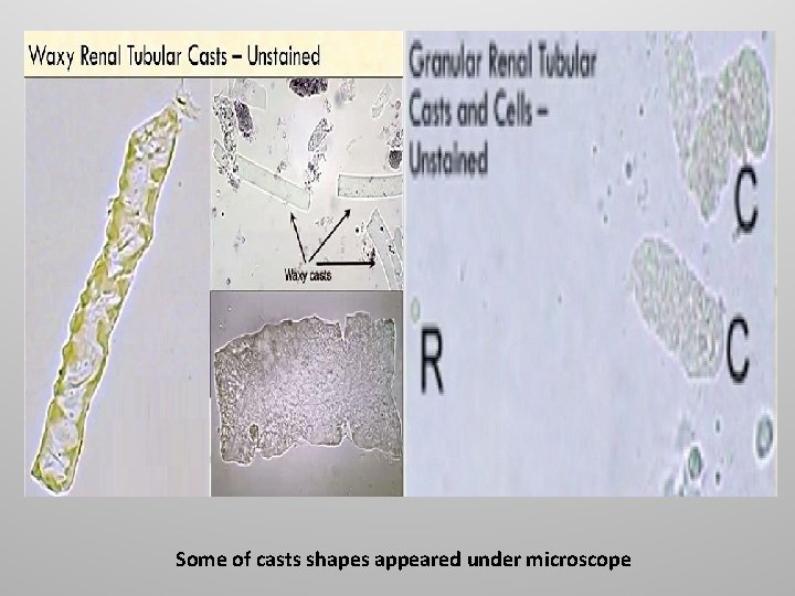 Some of casts shapes appeared under microscope 