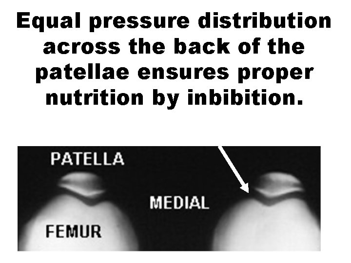 Equal pressure distribution across the back of the patellae ensures proper nutrition by inbibition.