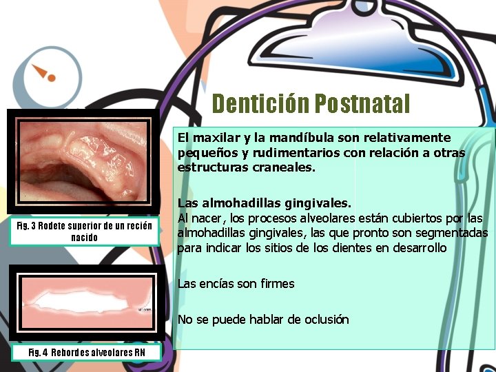 Dentición Postnatal El maxilar y la mandíbula son relativamente pequeños y rudimentarios con relación