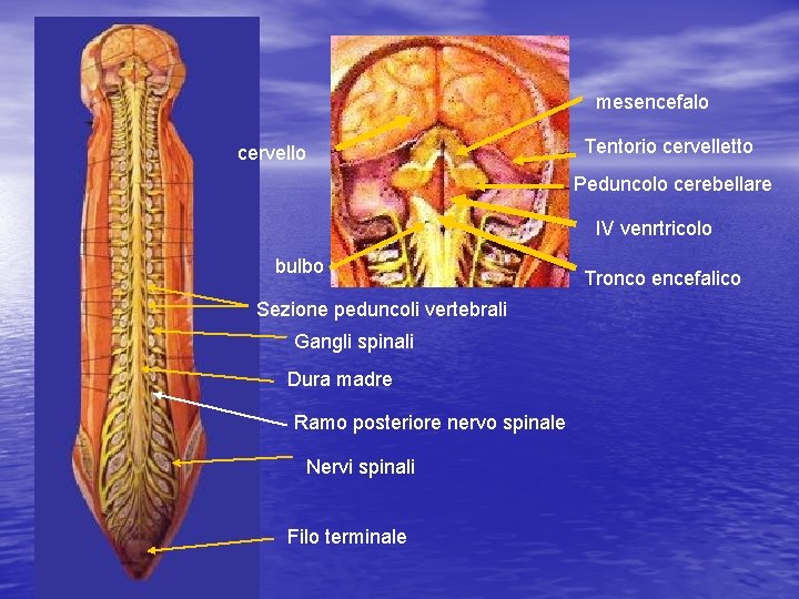 mesencefalo Tentorio cervelletto cervello Peduncolo cerebellare IV venrtricolo bulbo Sezione peduncoli vertebrali Gangli spinali