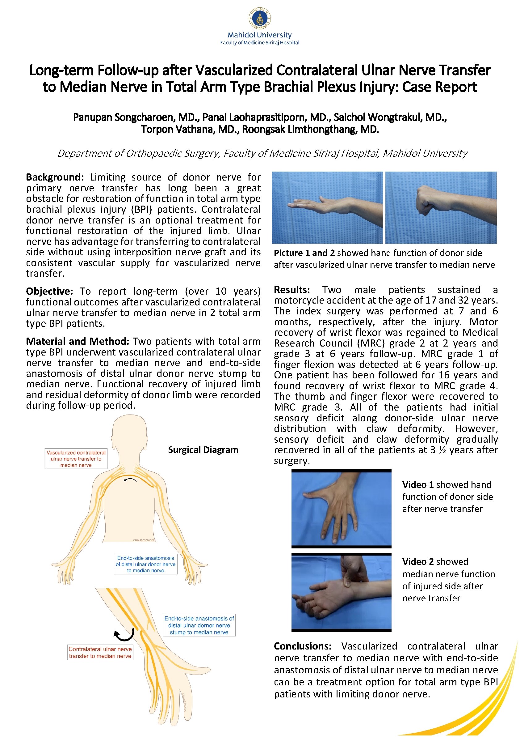 Long-term Follow-up after Vascularized Contralateral Ulnar Nerve Transfer to Median Nerve in Total Arm