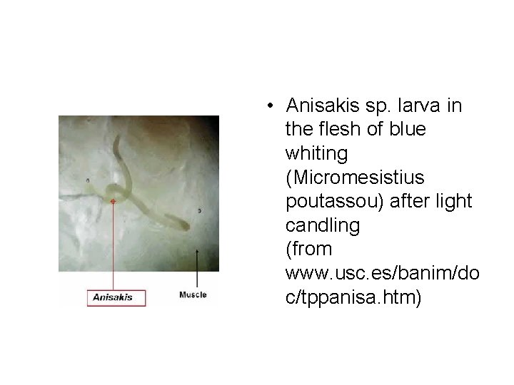  • Anisakis sp. larva in the flesh of blue whiting (Micromesistius poutassou) after