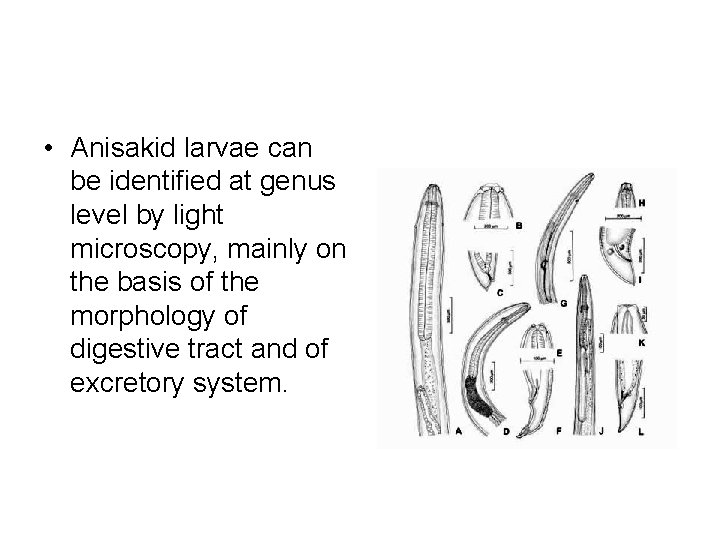  • Anisakid larvae can be identified at genus level by light microscopy, mainly