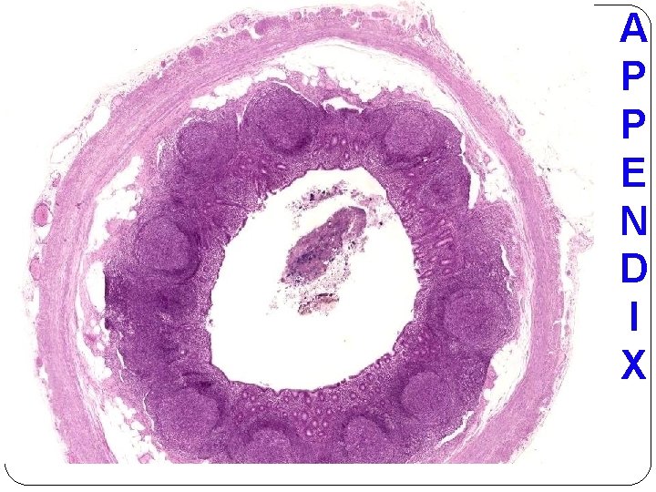 Apendix Colour Foundation blockPathology Practical Cell injury and inflammation Dr