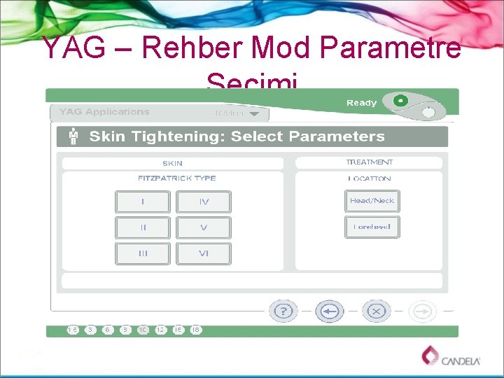 YAG – Rehber Mod Parametre Seçimi 