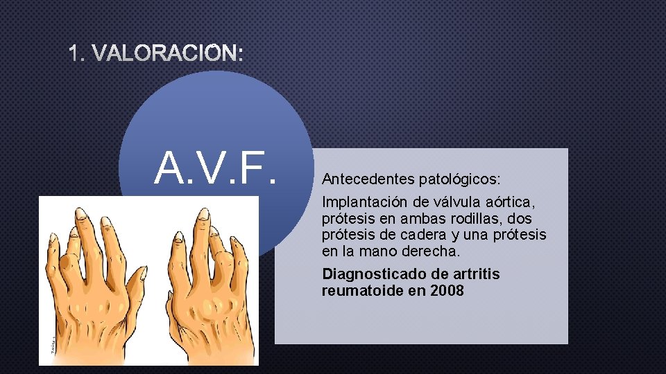 1. VALORACIÓN: A. V. F. Antecedentes patológicos: Implantación de válvula aórtica, prótesis en ambas