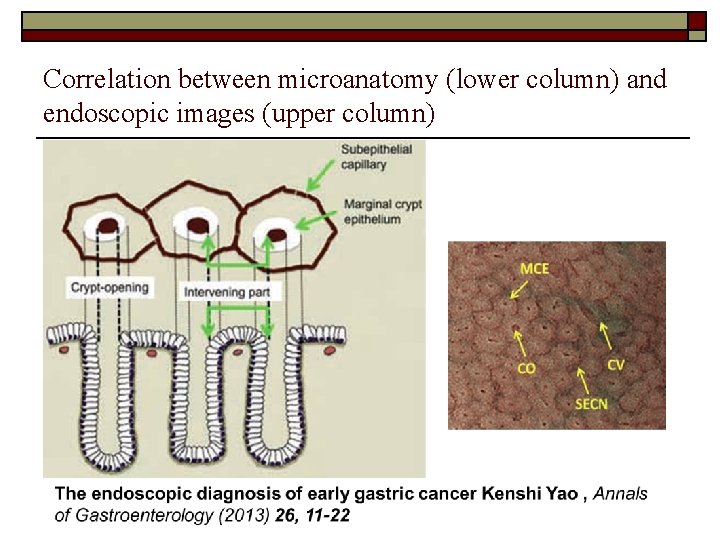 Correlation between microanatomy (lower column) and endoscopic images (upper column) 