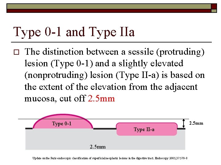 Type 0 -1 and Type IIa o The distinction between a sessile (protruding) lesion