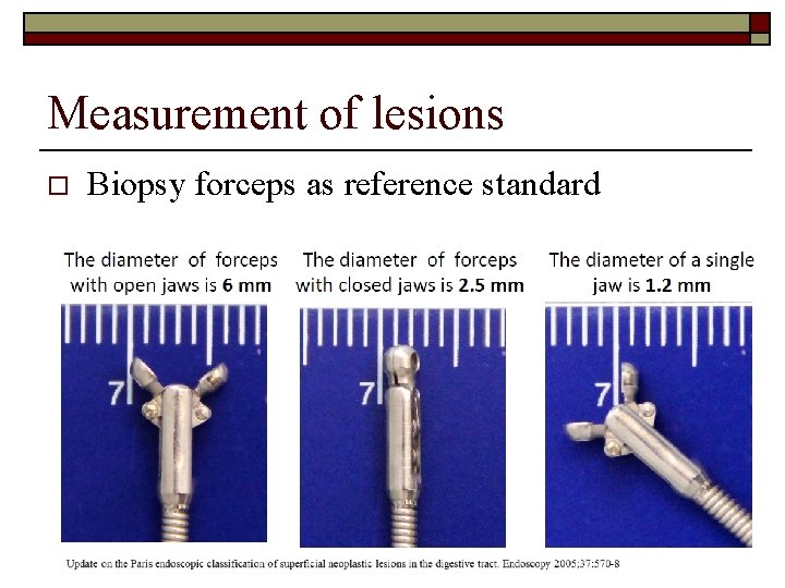 Measurement of lesions o Biopsy forceps as reference standard 