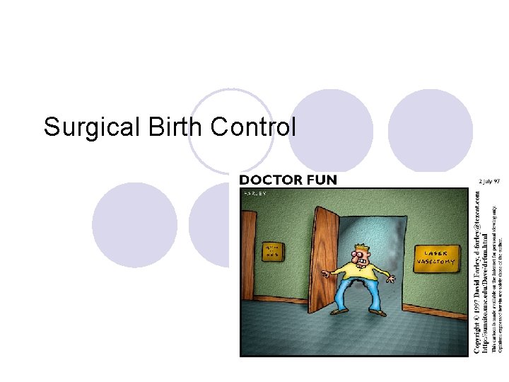 Surgical Birth Control 