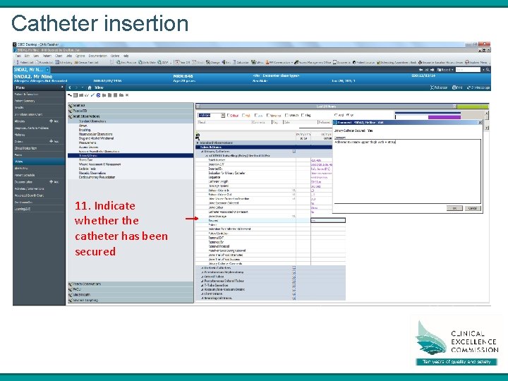 Catheter insertion 11. Indicate whether the catheter has been secured 