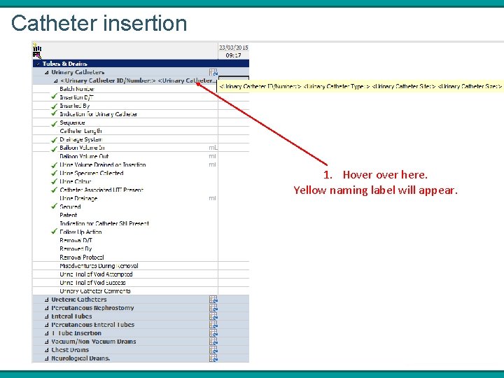 Catheter insertion 1. Hover here. Yellow naming label will appear. 