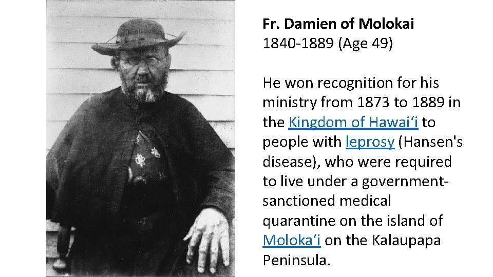Fr. Damien of Molokai 1840 -1889 (Age 49) He won recognition for his ministry