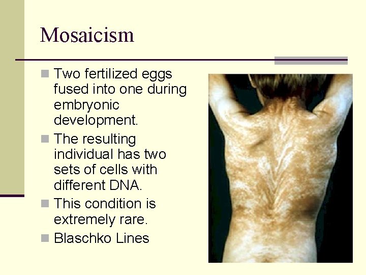 Mosaicism n Two fertilized eggs fused into one during embryonic development. n The resulting