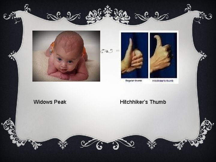 Widows Peak Hitchhiker’s Thumb 