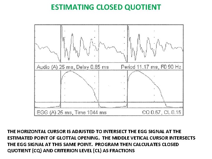 ESTIMATING CLOSED QUOTIENT THE HORIZONTAL CURSOR IS ADJUSTED TO INTERSECT THE EGG SIGNAL AT