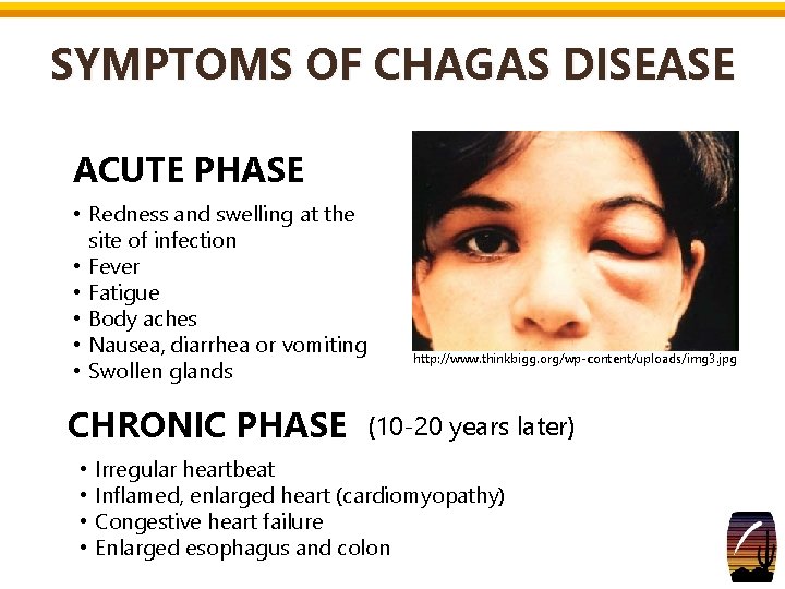 SYMPTOMS OF CHAGAS DISEASE ACUTE PHASE • Redness and swelling at the site of SYMPTOMS OF CHAGAS DISEASE ACUTE PHASE • Redness and swelling at the site of