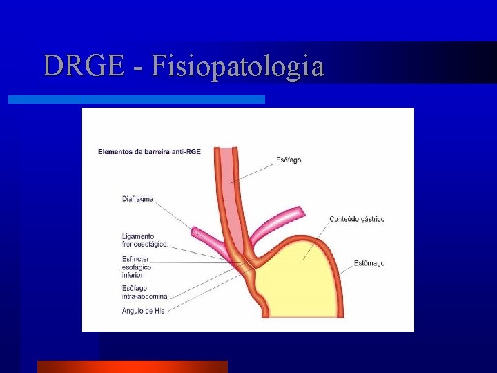 DRGE - Fisiopatologia 