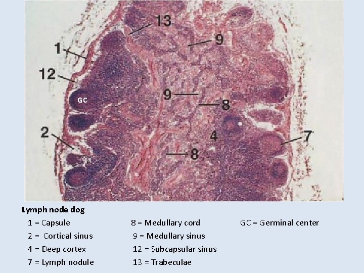 GC Lymph node dog 1 = Capsule 2 = Cortical sinus 4 = Deep