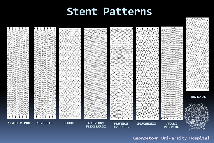 Stent Patterns SENTINOL ABSOLUTE PRO ABSOLUTE XCEED LIFESTENT FLEXSTAR XL PROTEGE EVERFLEX E·LUMINEXX SMART