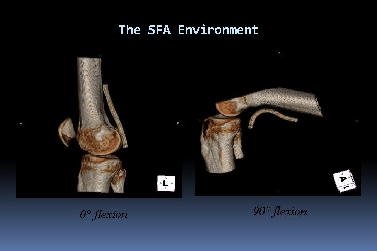 The SFA Environment 0° flexion 90° flexion 