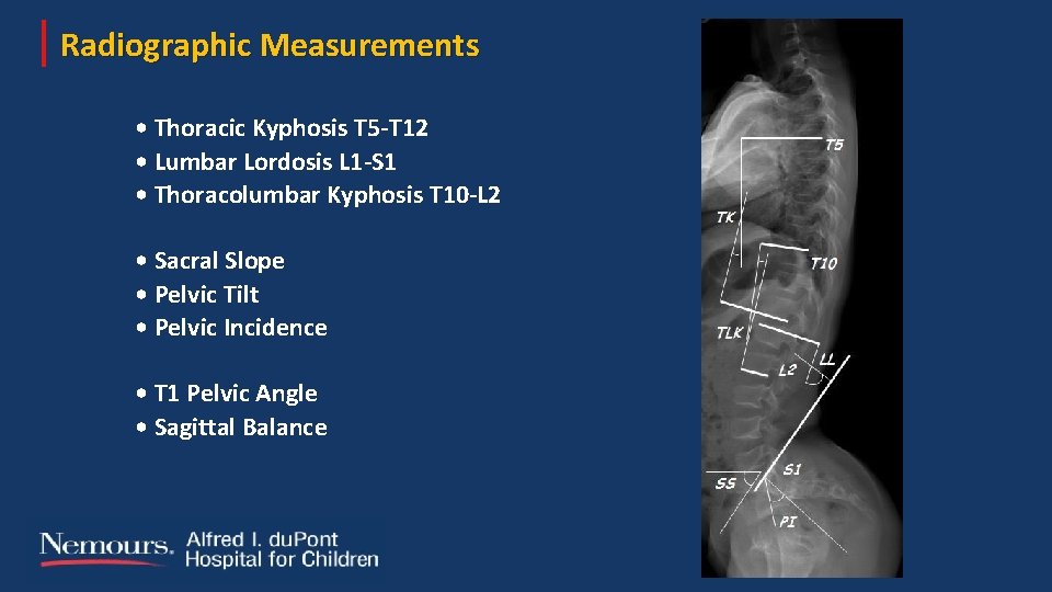 Radiographic Measurements • Thoracic Kyphosis T 5 -T 12 • Lumbar Lordosis L 1