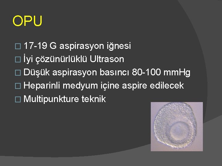 OPU � 17 -19 G aspirasyon iğnesi � İyi çözünürlüklü Ultrason � Düşük aspirasyon