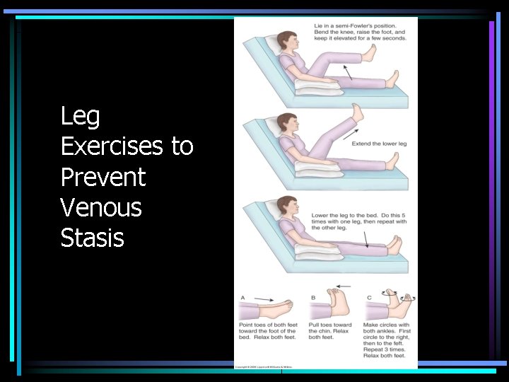 Leg Exercises to Prevent Venous Stasis 