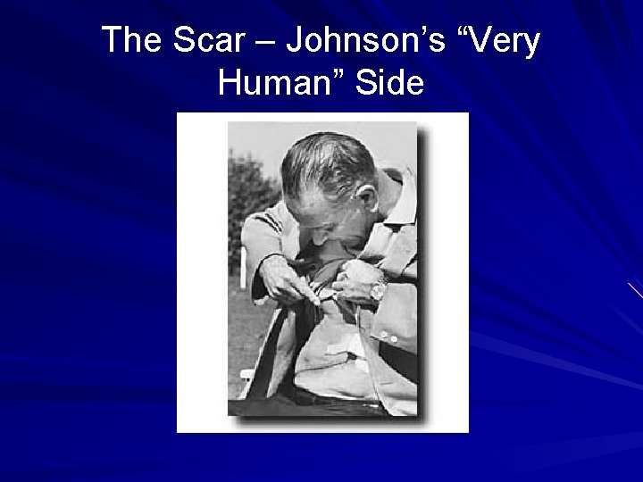 The Scar – Johnson’s “Very Human” Side The Scar – Johnson’s “Very Human” Side