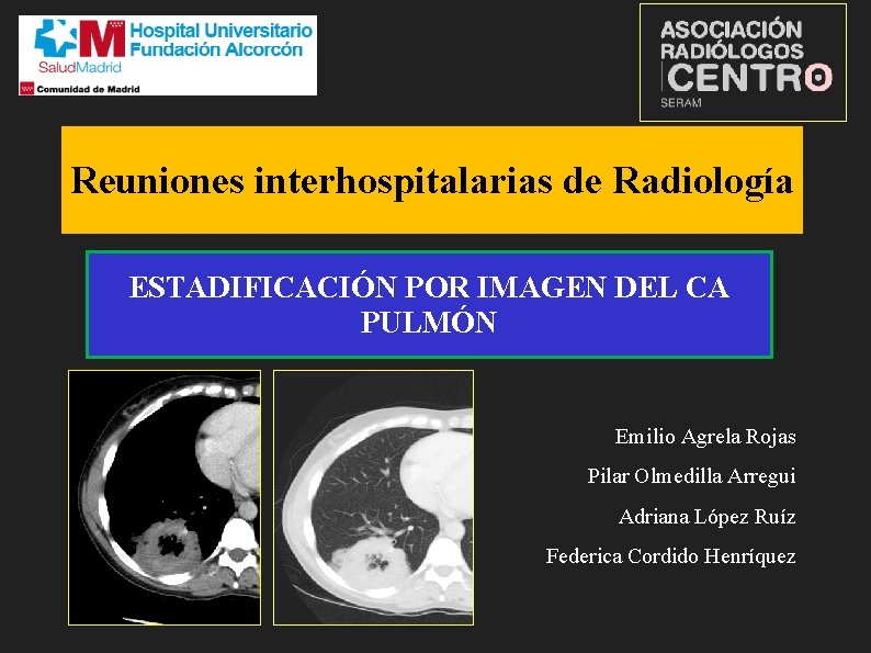 Reuniones interhospitalarias de Radiología ESTADIFICACIÓN POR IMAGEN DEL CA PULMÓN Emilio Agrela Rojas Pilar