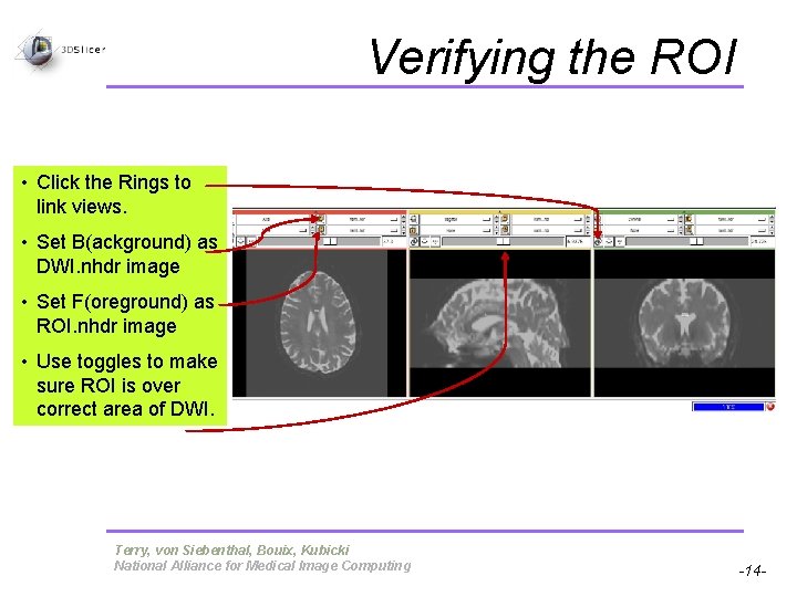 Verifying the ROI • Click the Rings to link views. • Set B(ackground) as