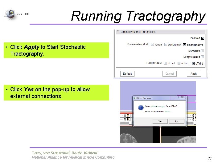 Running Tractography • Click Apply to Start Stochastic Tractography. • Click Yes on the