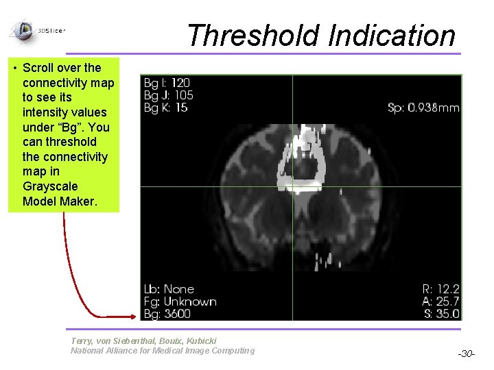Threshold Indication • Scroll over the connectivity map to see its intensity values under