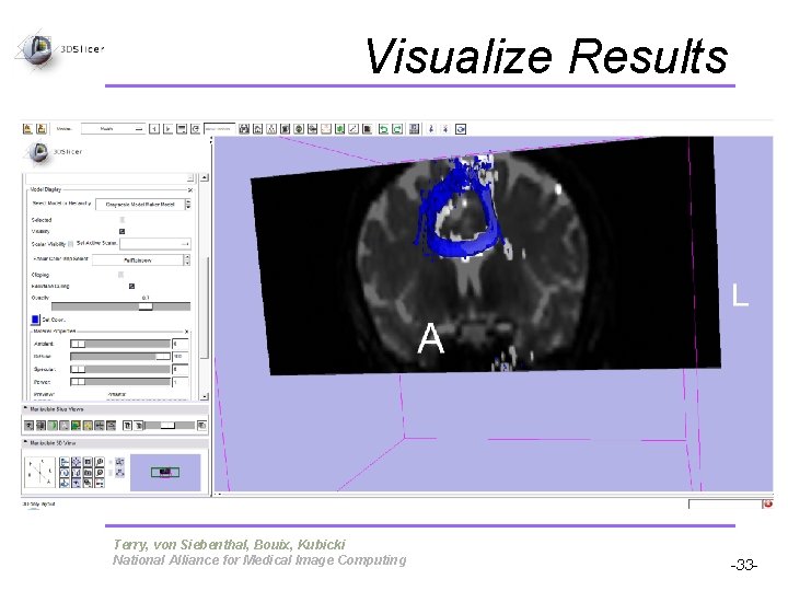 Visualize Results Pujol S, Gollub R Terry, von Siebenthal, Bouix, Kubicki National Alliance for