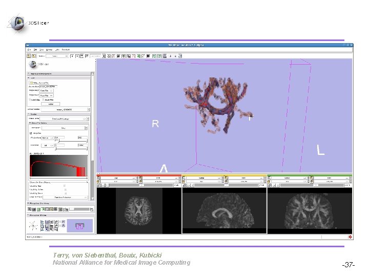 Pujol S, Gollub R Terry, von Siebenthal, Bouix, Kubicki National Alliance for Medical Image