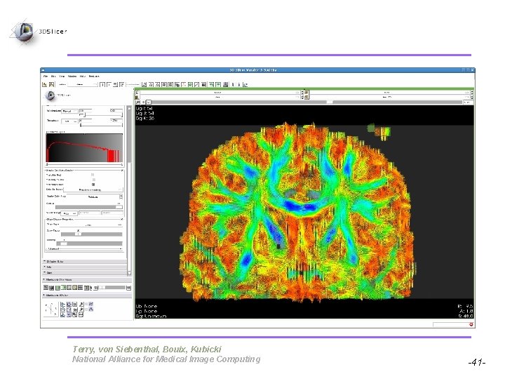 Pujol S, Gollub R Terry, von Siebenthal, Bouix, Kubicki National Alliance for Medical Image