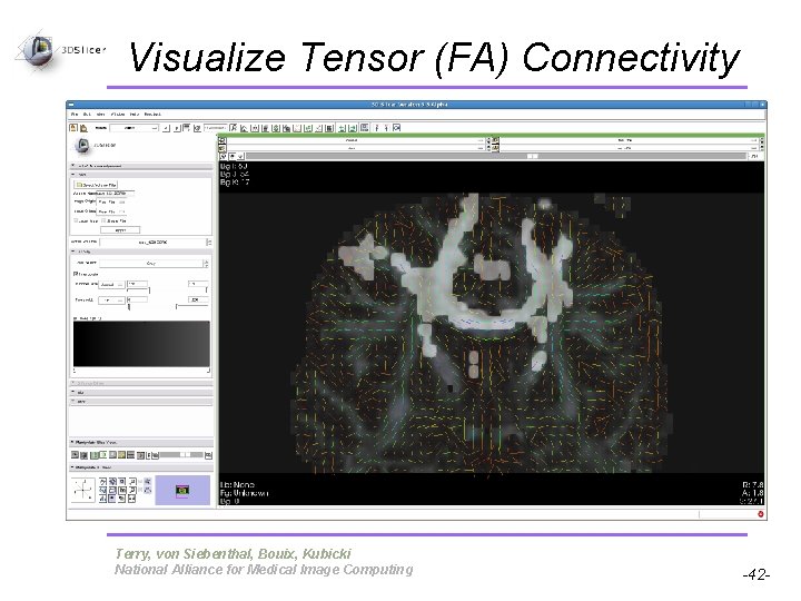 Visualize Tensor (FA) Connectivity Pujol S, Gollub R Terry, von Siebenthal, Bouix, Kubicki National
