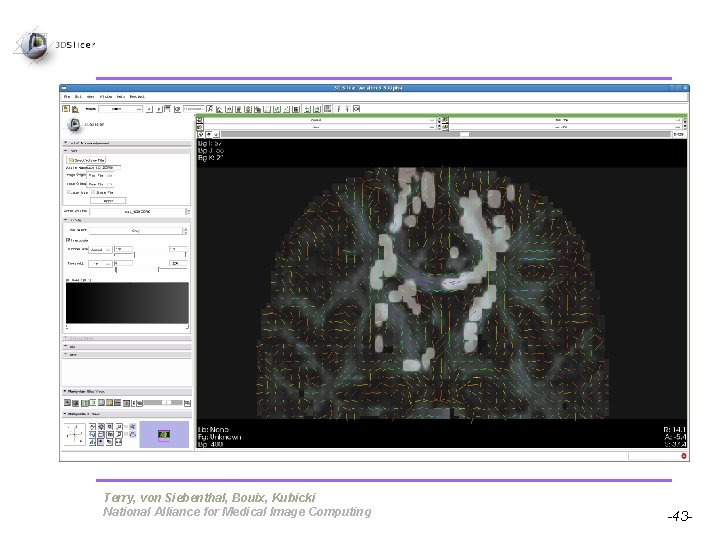 Pujol S, Gollub R Terry, von Siebenthal, Bouix, Kubicki National Alliance for Medical Image