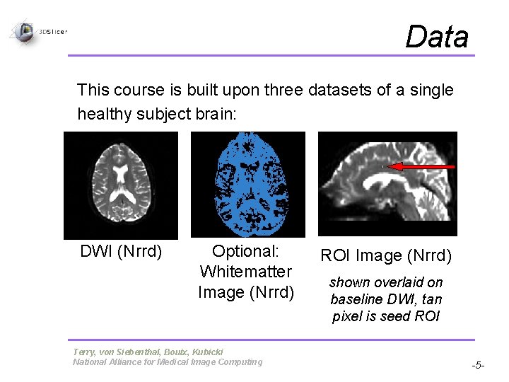 Data This course is built upon three datasets of a single healthy subject brain: