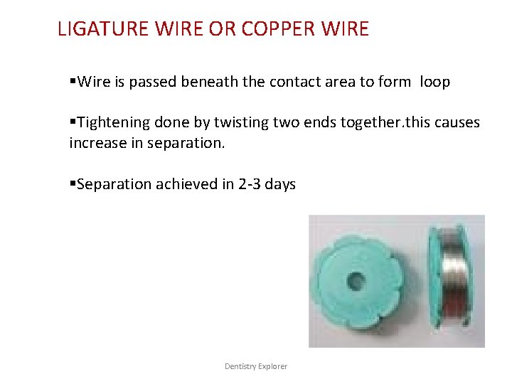 LIGATURE WIRE OR COPPER WIRE §Wire is passed beneath the contact area to form