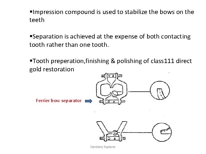 §Impression compound is used to stabilize the bows on the teeth §Separation is achieved